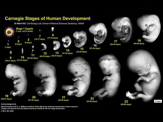胎心胎芽发育图
